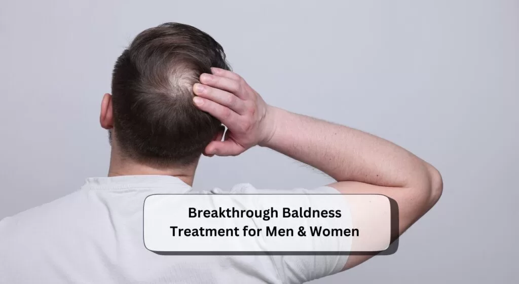 Baldness Treatment