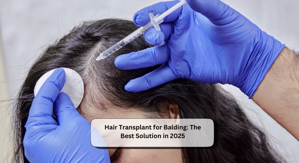 Hair Transplant for Balding