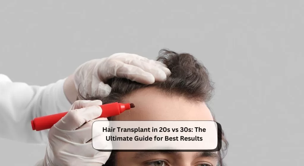 Hair Transplant in 20s vs 30s