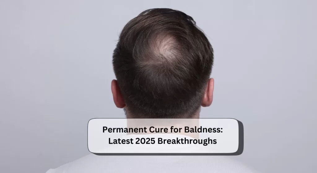 Permanent Cure for Baldness