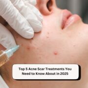 Acne Scar Treatments