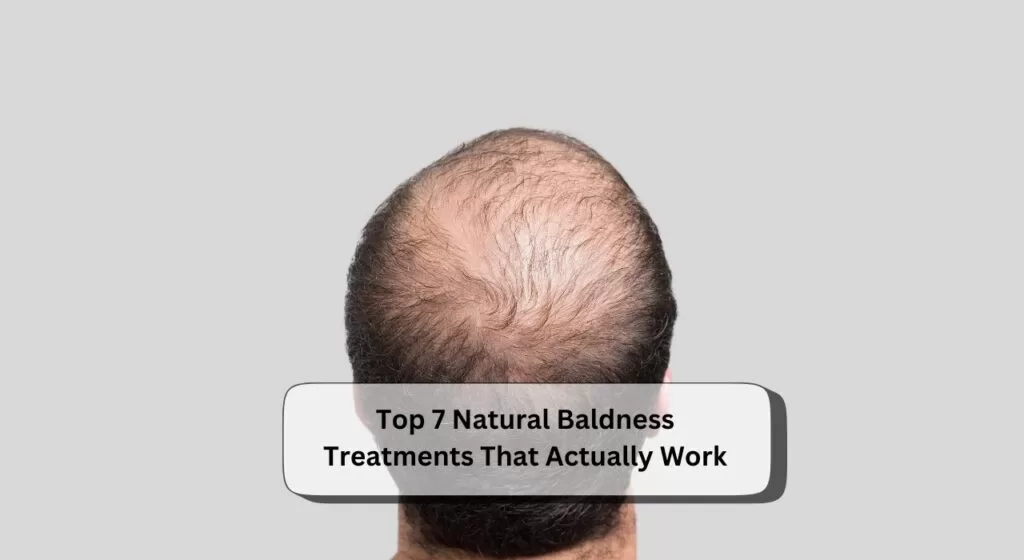 Natural Baldness Treatments