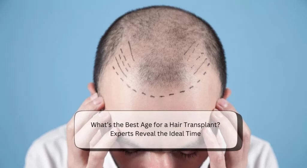 Best Age for Hair Transplant