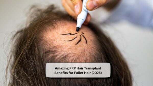 PRP Hair Transplant Benefits