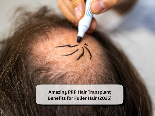 PRP Hair Transplant Benefits