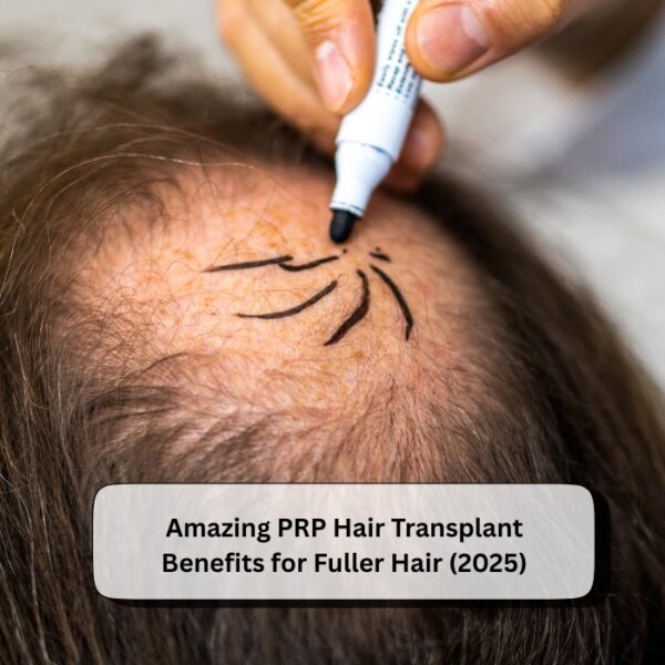 PRP Hair Transplant Benefits