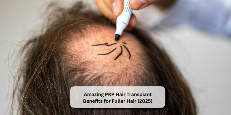PRP Hair Transplant Benefits