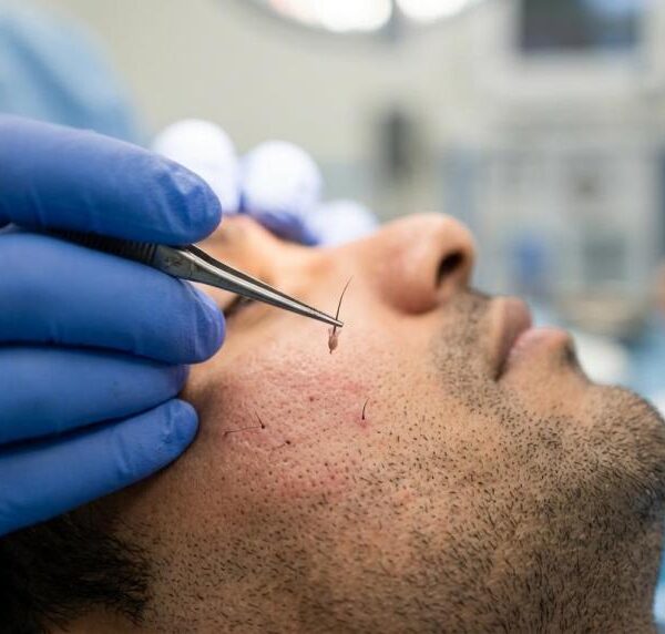 beard restoration