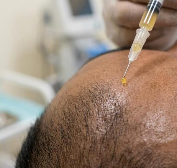 prp hair therapy