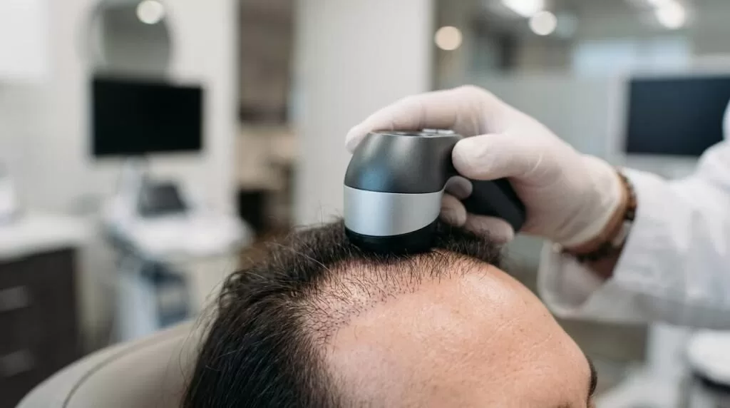 best hair transplant clinic in pune
