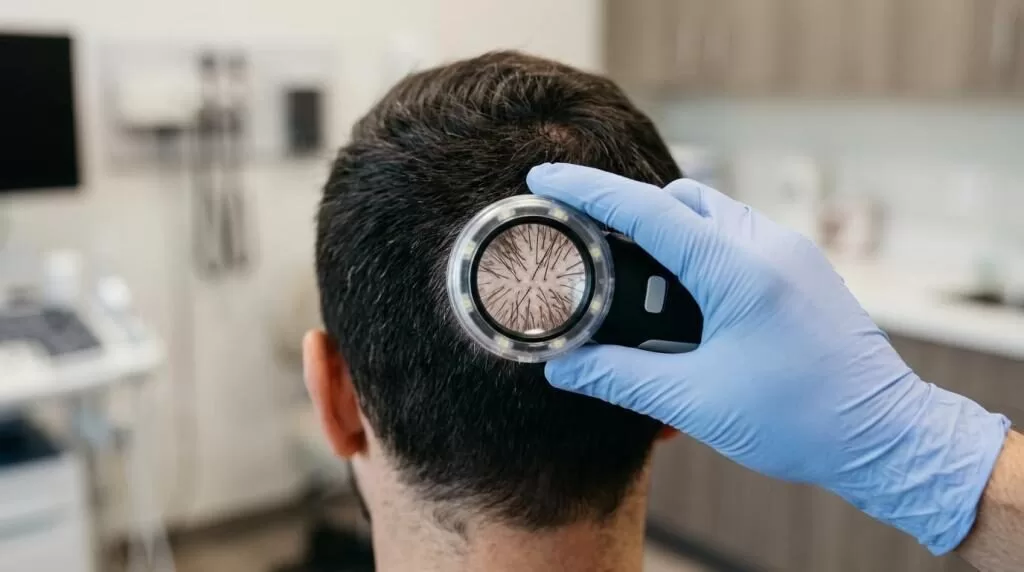 when to get a hair transplant